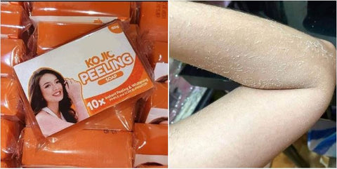 ROSMAR KOJIC PEELING SOAP