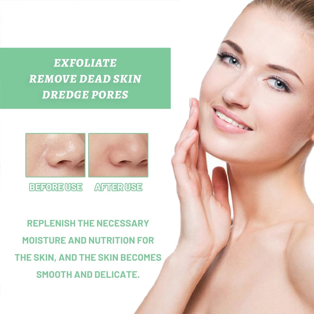 (BUY 1 TAKE 1) She Eureka Exfoliating Gel 100g Gently Cleans Closed Black Mouth Shrinks Pore Exfoliate