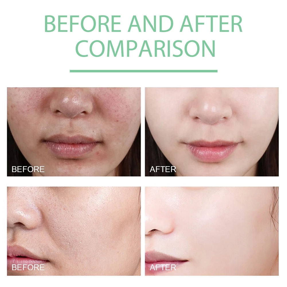(BUY 1 TAKE 1) She Eureka Exfoliating Gel 100g Gently Cleans Closed Black Mouth Shrinks Pore Exfoliate