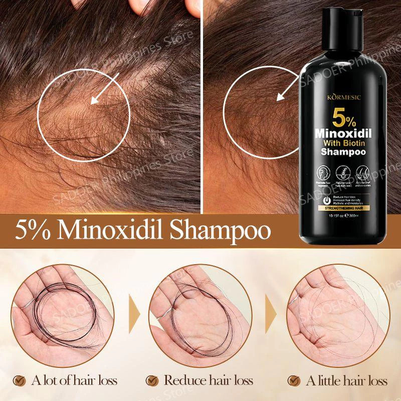 Minoxidil 5% Hair Grower Shampoo with Biotin for Hair Loss Treatment Regrowth Hair