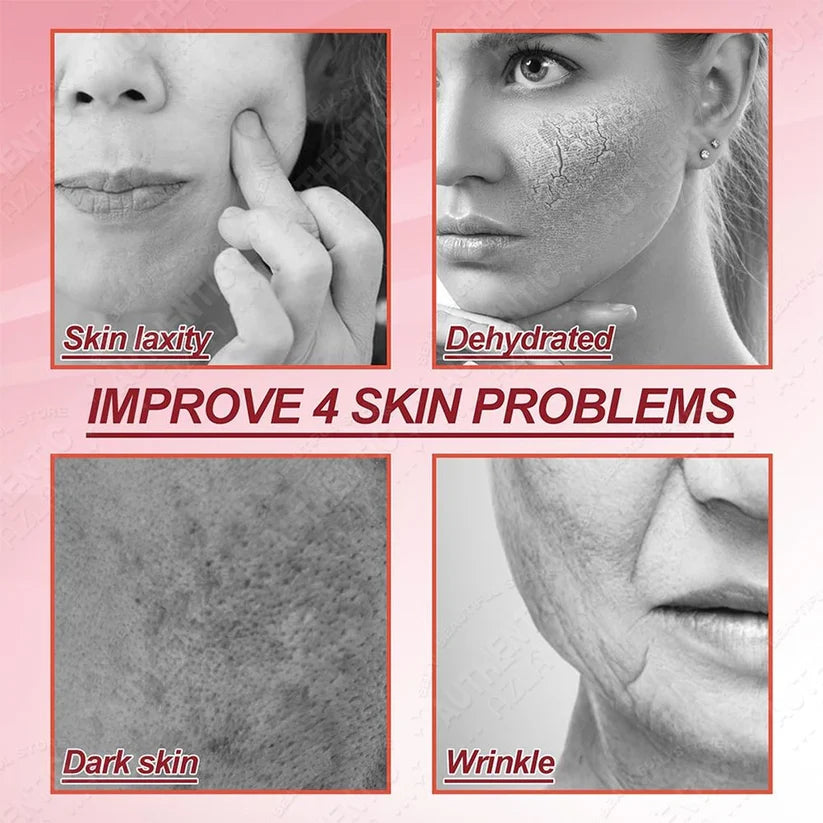 Retinol Cream Dragon Blood Cream Whitening Moisturizing Melasma Remover Ance Freckles Remover 50g